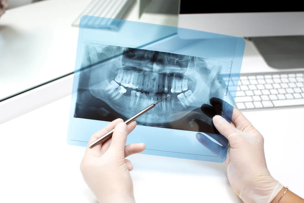 Endodontia 1 (1) 1